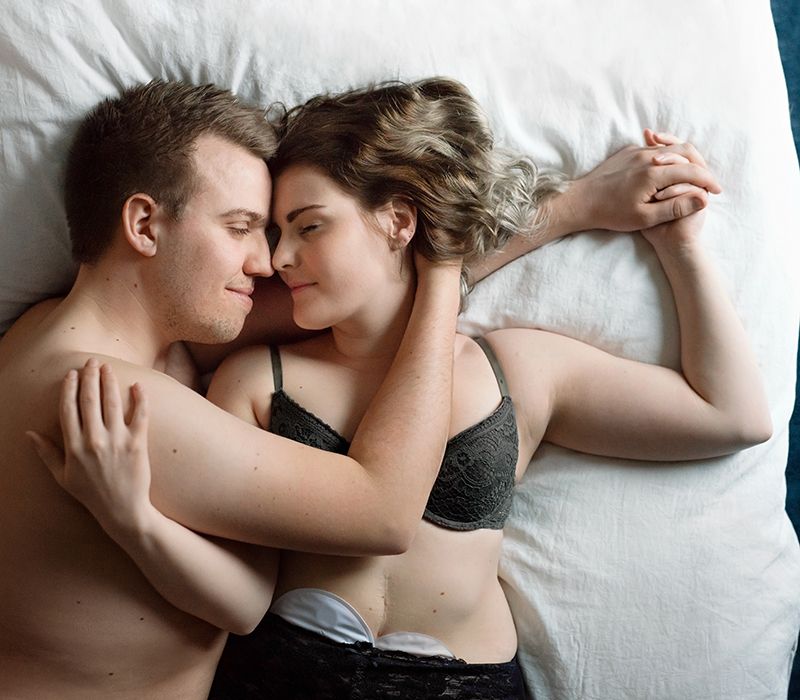 Stomi og seksualitet - erfaringer fra en stomioperert