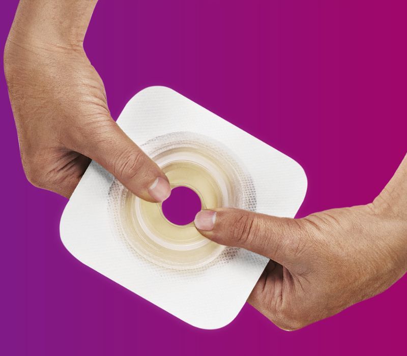 Convatec Moldable Technology™